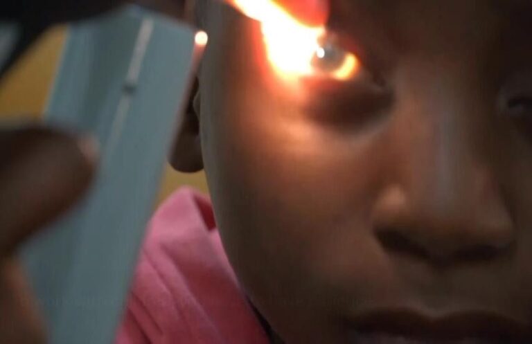 El único oftalmólogo de Burkina Faso para niños ve el trauma tanto del juego como del conflicto
